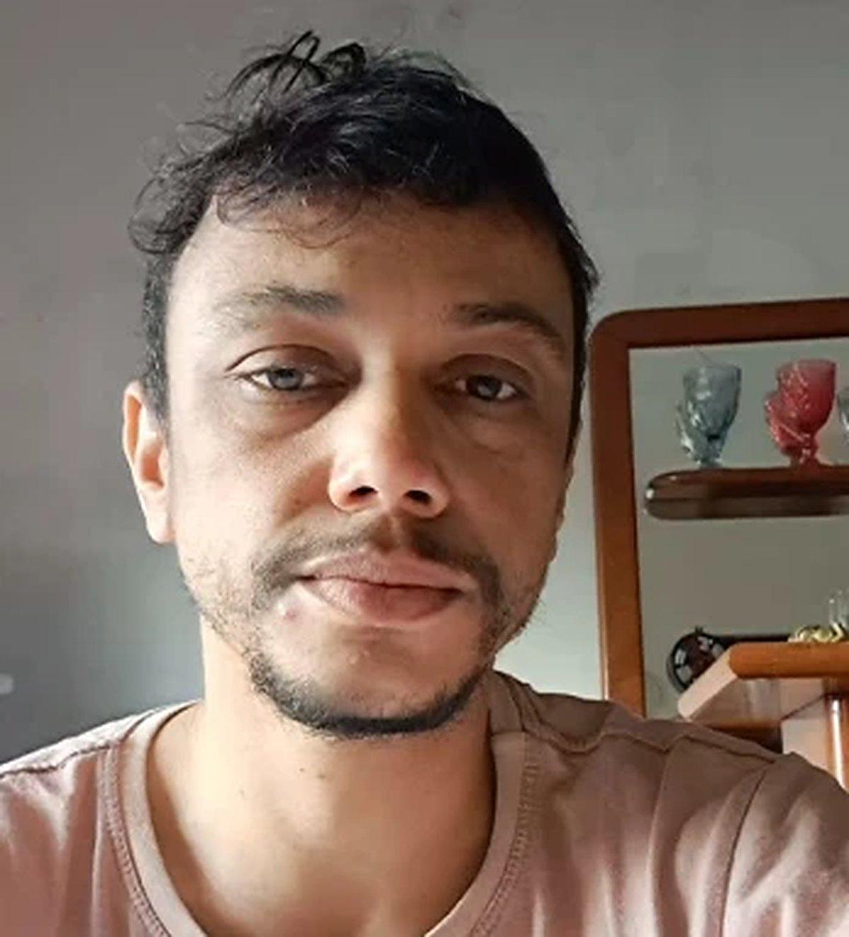 Itabirano mobiliza campanha para arrecadar R$ 35 mil para tratamento dos olhos